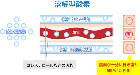 高気圧酸素カプセルOXYRIUM-Medical(1.5気圧)