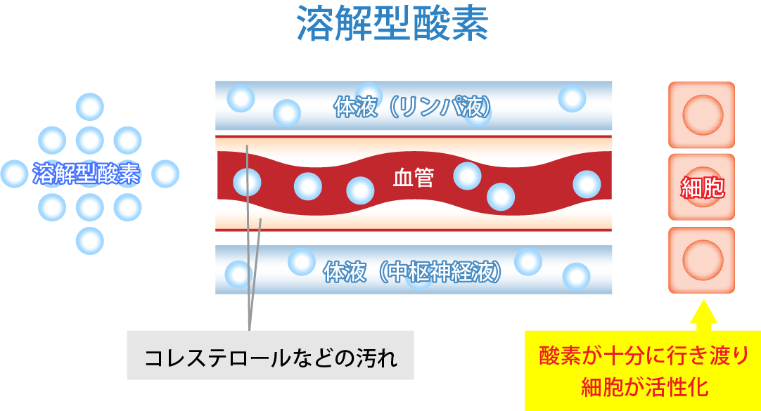 【受注生産】高気圧酸素BOX OXYROOM(1.35気圧)